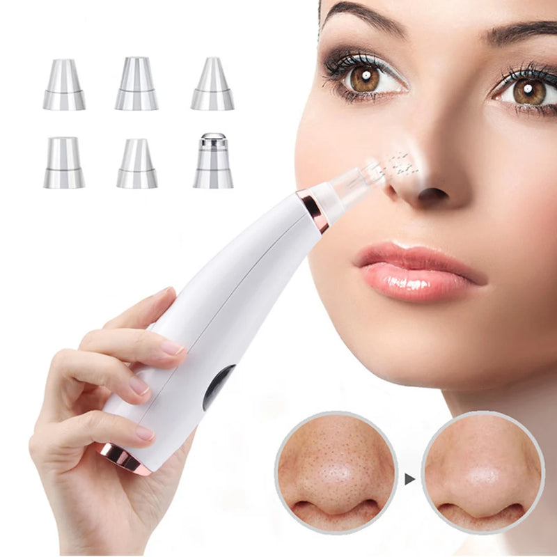 Blackhead Remover Vacuum