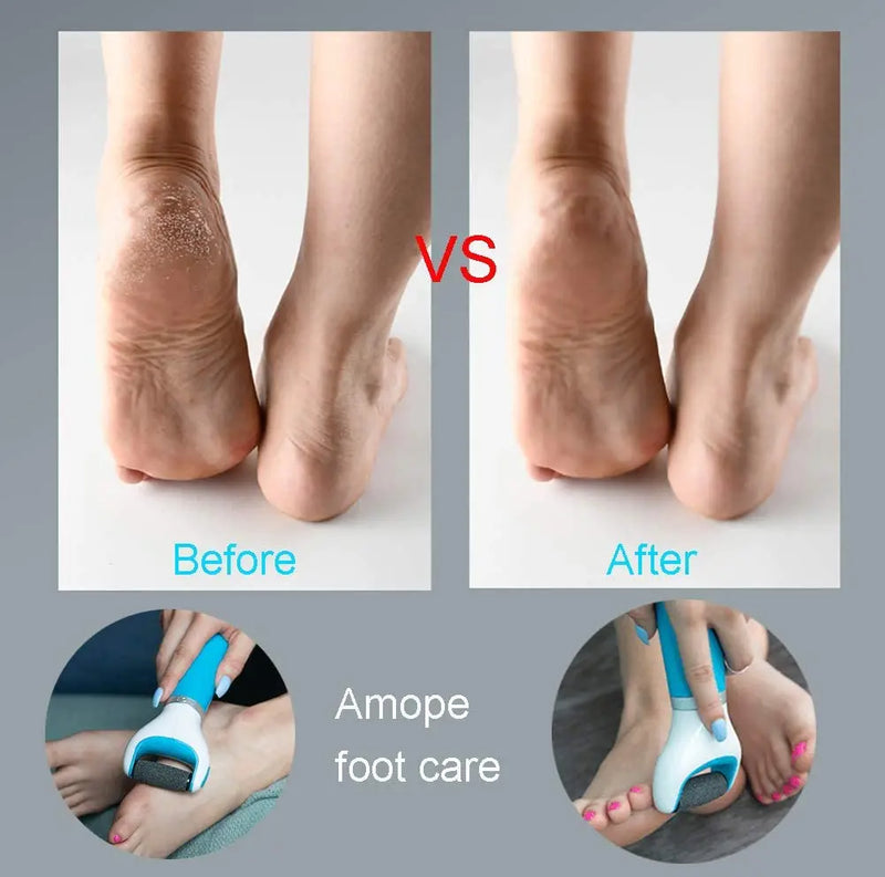 Electric Foot File Callus Remover