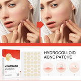 144pcs Acne Pimple Patch Set